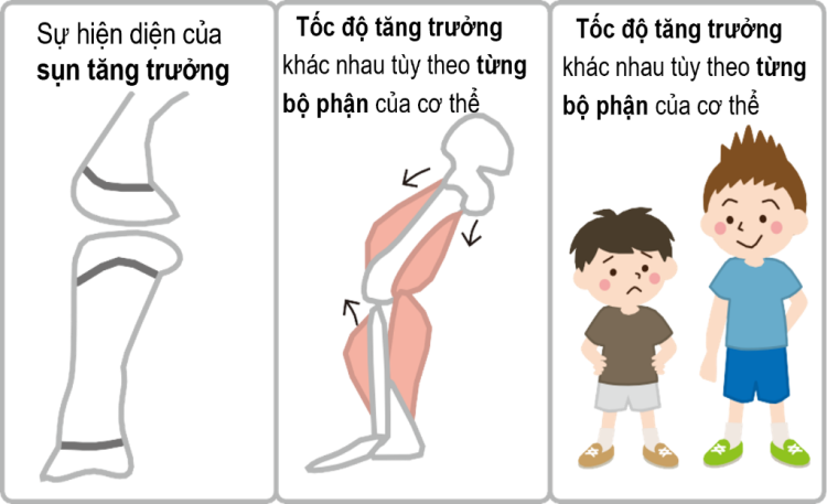 Các đặc điểm liên quan đến sự phát triển chiều cao: